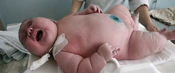 Le plus gros bébé au monde 