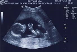 Un foetus de 14 semaines qui tape des mains dans le ventre de sa maman