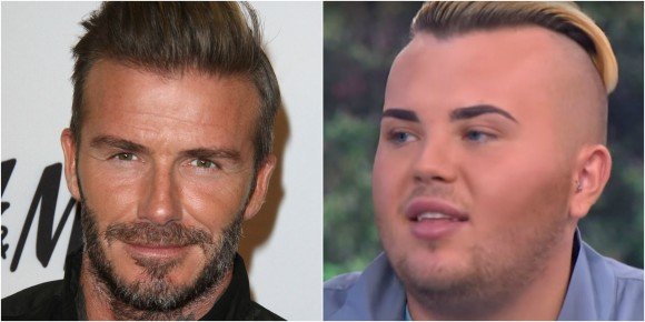35 000$ en chirurgie pour ressembler à David Beckham