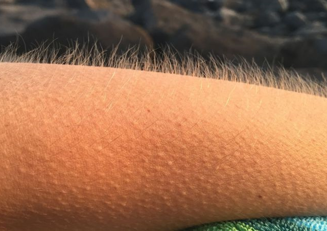 Voici pourquoi nous avons la chair de poule quand nous écoutons de la musique!