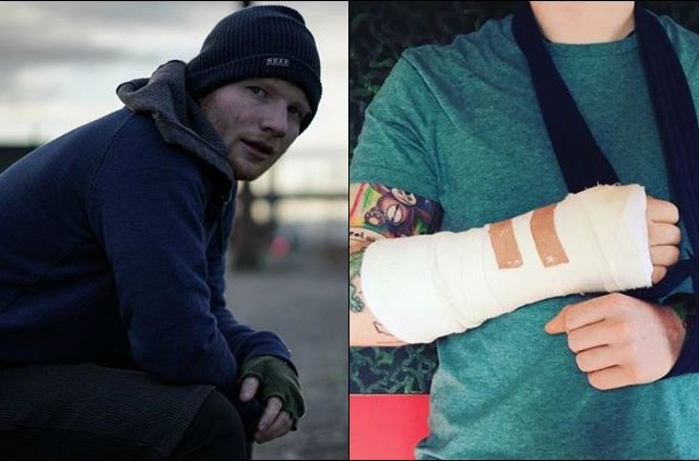 Ed Sheeran pourrait annuler certains spectacles...