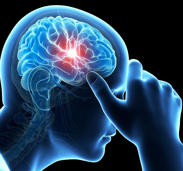 Commotions cérébrales : un guide pratique pour les parents